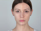 woman's face half with makeup and half without makeup